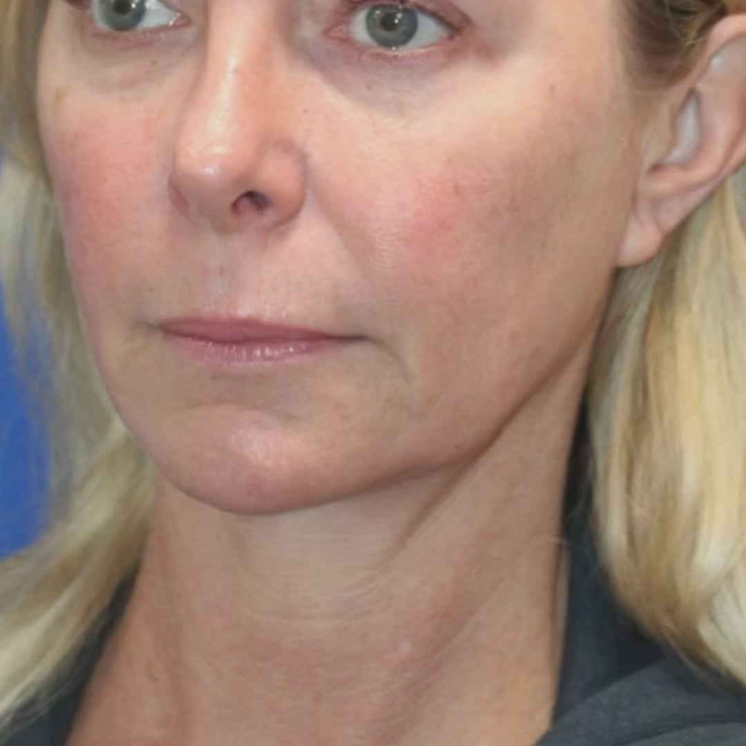 Vidéo